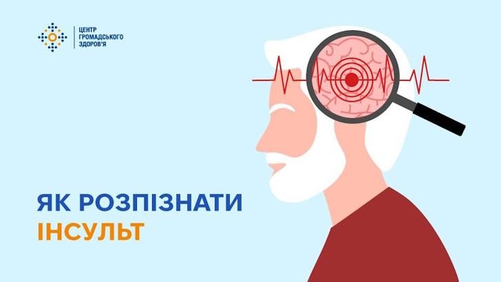 Як розпізнати інсульт